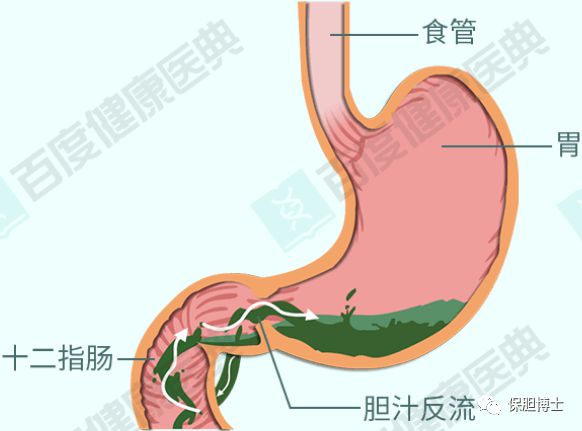 发现意外和意外发现_意外：_意外怀孕怎么办