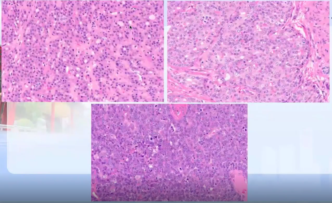 年11月11日盘锦市集中隔离管控人员例行核酸检测情况
