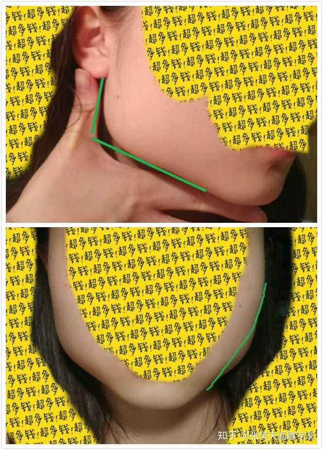 娱乐圈十大男明星明知是自毁,为何还是要动刀?