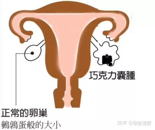 输卵管堵塞的7个问题，备孕中的你有所帮助