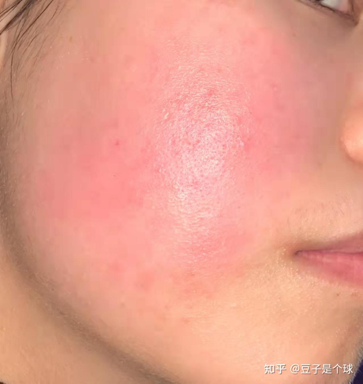 锦囊妙计皮肤出状况？专家教你如何“自救”不知道你注意到没有