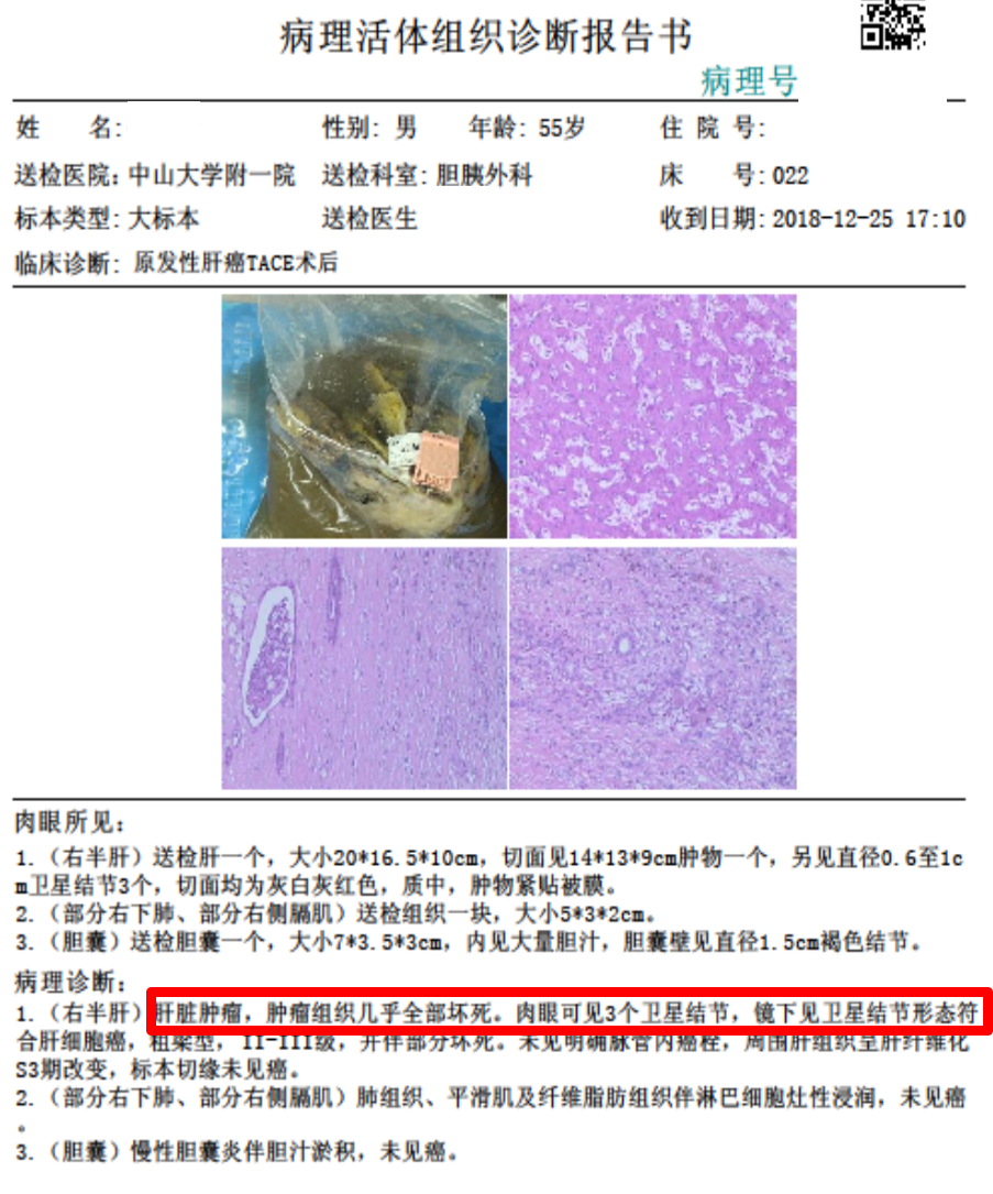 研究发现：_研究发现存在着同性恋基因对吗_研究发现的同义词