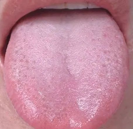 风水堂：内脏气血盛衰变化的方法