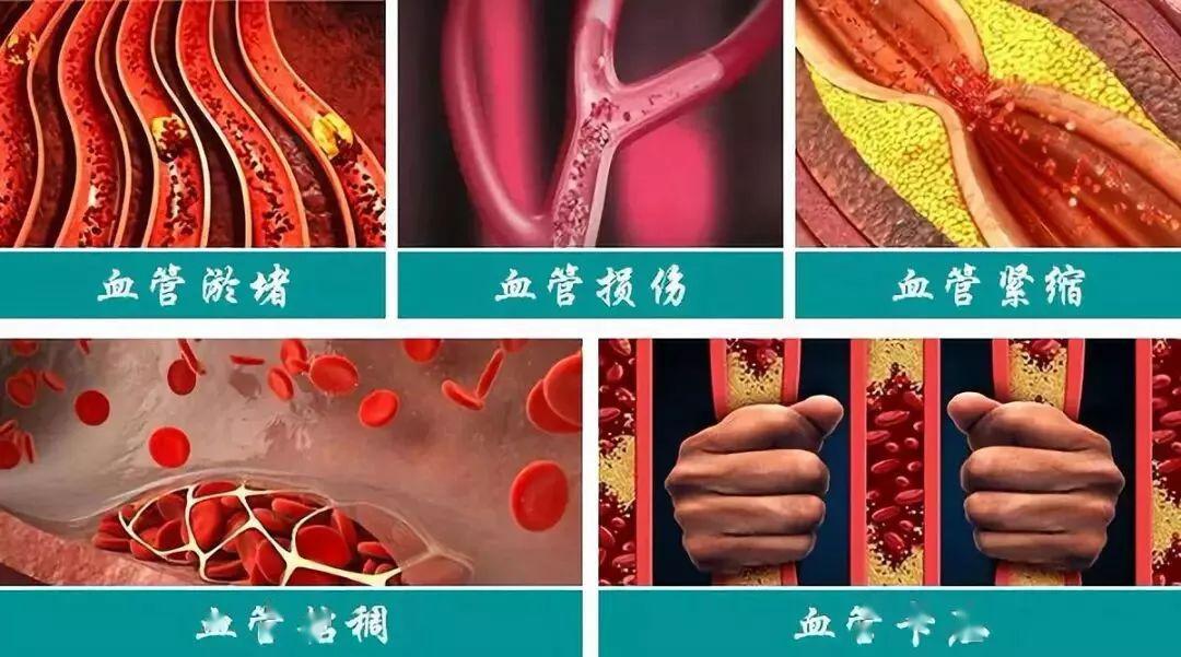 精囊炎：病因复杂多样，危害不容忽视