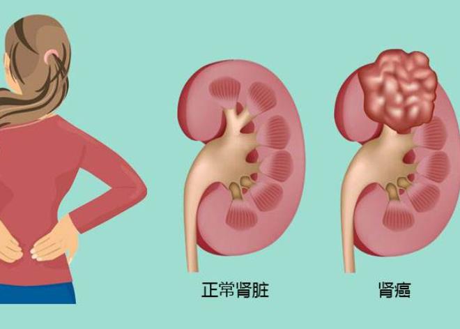 男科医生免费咨询_男科预约_男科